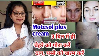 Motesol plus cream honest review  Motesol plus cream benefits uses & side effects in hindi 