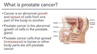 Prostate Cancer Overview