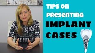 Tips on Presenting Implant Cases  Dental Practice Management Tip of the Week.