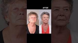 Face Fitness Transformation Simple Exercises for a Sculpted Look #Face Fitness #Facial Exercises