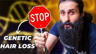 Stop Blaming Your Genetics For Hair Loss - Fix This Instead  Bearded Chokra