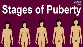 What are the Stages of Puberty in Girls?