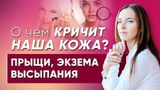 О чем кричит наша кожа?  Психосоматика прыщей высыпаний экземы