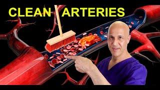The Best Foods to Clean Arteries & Reverse Plaque Prevent Heart Attack & Stroke   Dr. Mandell