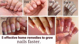 grow nails in just 3 days faster nail growth tips  How to grow Nails  faster in one day 