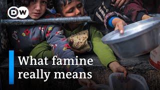 Gaza famine could hurt peoples health for decades  DW News