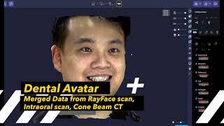 RayFace Dental Avatar