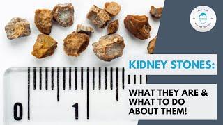 Kidney Stones What They Are And What To Do About Them