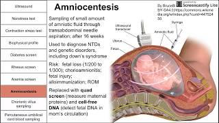 Prenatal screening fetal testing and other tests during pregnancy