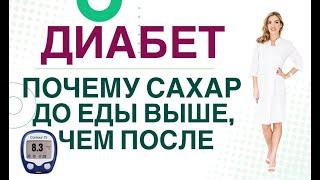  Сахарный диабет. Высокий сахар до еды как снизить? Врач эндокринолог диетолог Ольга Павлова.