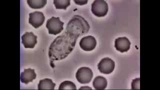 Globuli bianchi a caccia di batteri