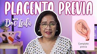 TUNGKOL SA PLACENTA PREVIA with Doc Leila OB-GYN Philippines