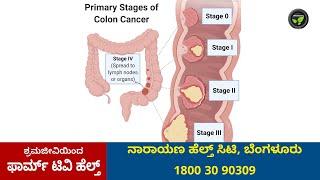 ಕರುಳಿನ ಕ್ಯಾನ್ಸರ್ - ಏನು ತಡೆ ಚಿಕಿತ್ಸೆ ಮತ್ತು ನಿರ್ವಹಣೆ - ಡಾ. ಸುಶೃತ ಶೆಟ್ಟಿ   What is Colon Cancer