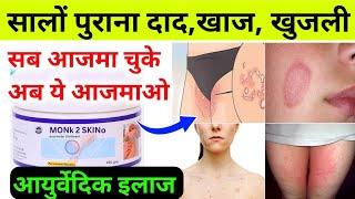 सालों पुराना दादखाज खुजली को 7 दिनों में जङ से कैसे खत्म करें- monk 2 skino cream review hindi