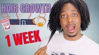 How To Make Your Hair Grow Faster In 1 Week  WINSTONEE