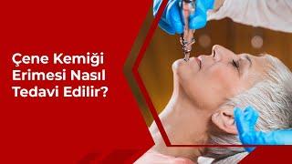 Çene Kemiği Erimesi Nasıl Tedavi Edilir?