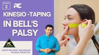 KINESIO-TAPING TECHNIQUES FOR BELLS PALSY PATIENT  LEARN TAPING TO RECOVER FACIAL MOVEMENTS