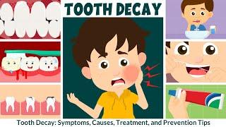 Tooth Decay Symptoms Causes Treatment and Prevention  Video for Kids  Learning Junction