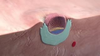 Implantation of the blastocyst