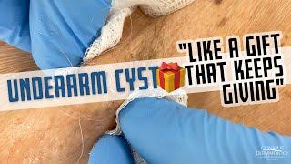 This Underarm Cyst is Like A Gift That Keeps Giving