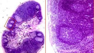 Histological preparations for the intermidiate Exam - 3  35