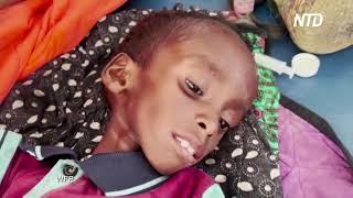 ООН 730 детей умерли за полгода в центрах помощи голодающим в Сомали