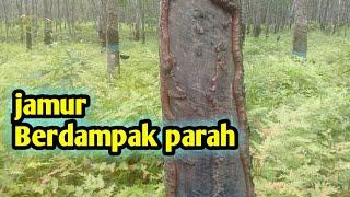 cara mengobati jamur kulit karet.