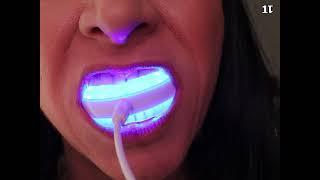 Teeth Whitening USB Led Blue Light  Unboxing Review and Demo
