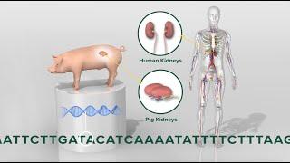 Pig-to-human kidney transplant 3D animation