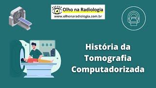 Filme História da Tomografia Computadorizada - O Início     #radiologia #tc #diagnosticoporimagem