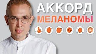 МЕЛАНОМА как распознать опасные родинки  ранняя диангостика