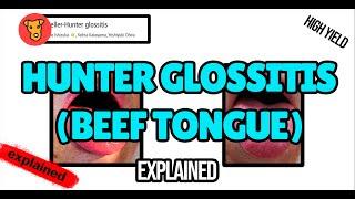 Hunter glossitis Beef tongue Pathogenesis of Signs and Symptoms in Medicine