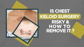 Is Chest Keloid Surgery Risky? Keloid Surgery in Delhi  Dr. PK Talwar