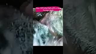 कान मैं से ये क्या निकला देखकर डर जाओगे  Huge dreaded insect inside ear 🪳🪳