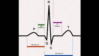 ECG The T Wave