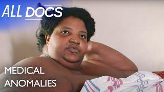 Dominique Lanoise 600 Pounds  S01 E05  Extraordinary People Documentary  All Documentary