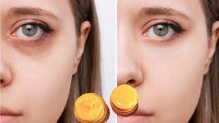 In just 3 days remove eye dark circles2 strong home remedies for eye dark circles#ophthalmologists