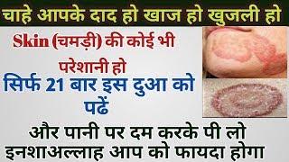 Is dua ko 21 baar Padho  Read only 21 time this dua and remove All type skin problems