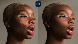 High-End Skin Retouching Beginner Photoshop Tutorial  Cleansing the face #photoshop