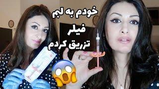 تزریق فیلر لب ژل هیالورونیک اسید فرم دهی و حجم دهی لب پروسه تزریق ژل لب خودم