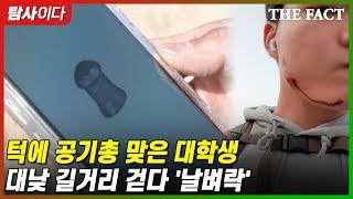 턱에 공기총 맞은 대학생...대낮 길거리 걷다 날벼락 탐사이다