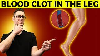 Blood Clot Symptoms & Signs Causes & Treatment of Leg Blood Clots