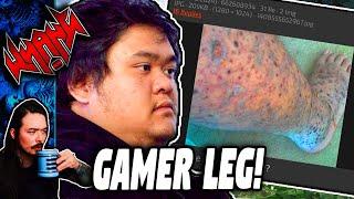 Gamer Leg - Tales From the Internet