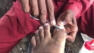 ASMR Toenail cutting by Experienced street nail cutter