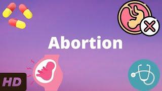 Abortion Everything You Need To Know