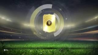 Sick pack opening - FIFA 15