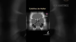 Celdilla de Haller en tomografía.