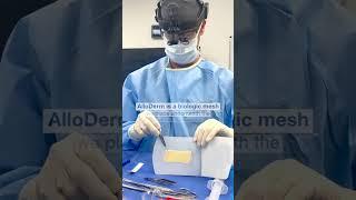 Inverted Nipple Repair with Dr. Zuri in Miami  Zuri Plastic Surgery