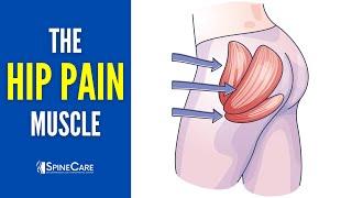 The Hip Pain Muscle How to Release It for INSTANT RELIEF