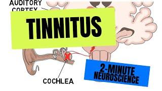 2-Minute Neuroscience Tinnitus
